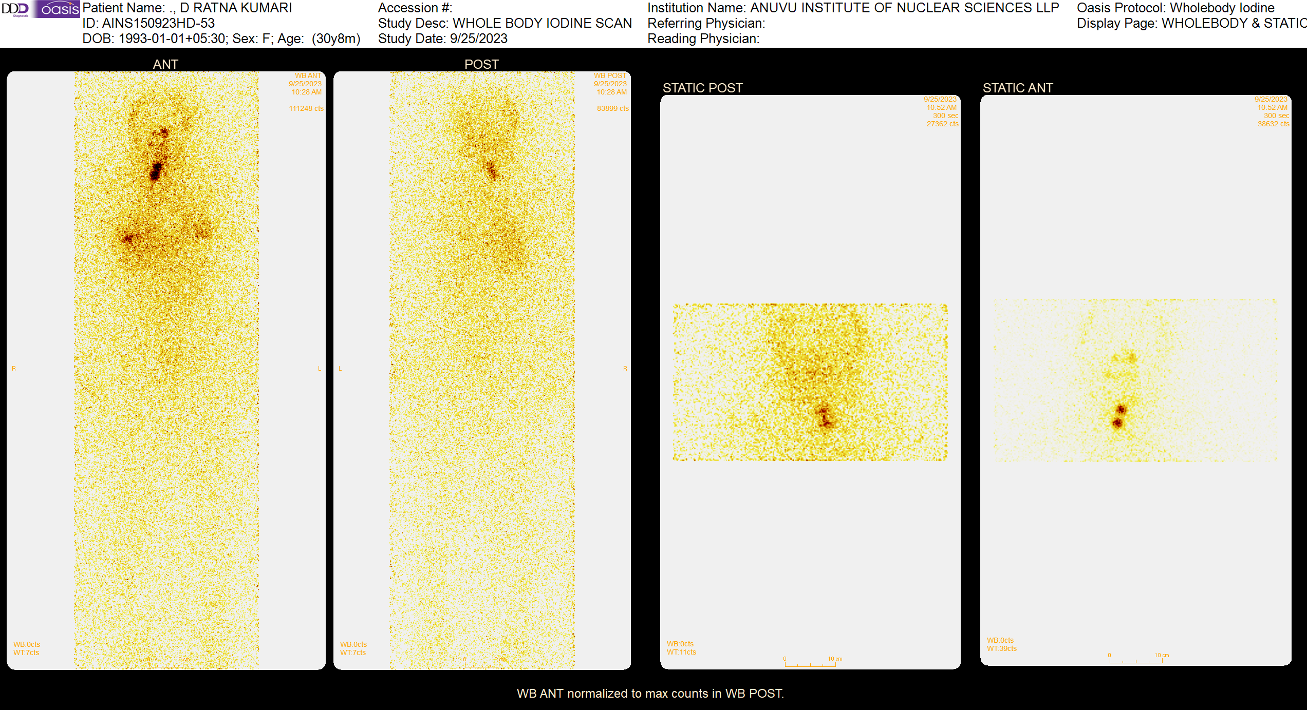 I131 High Dose Therapy Scan